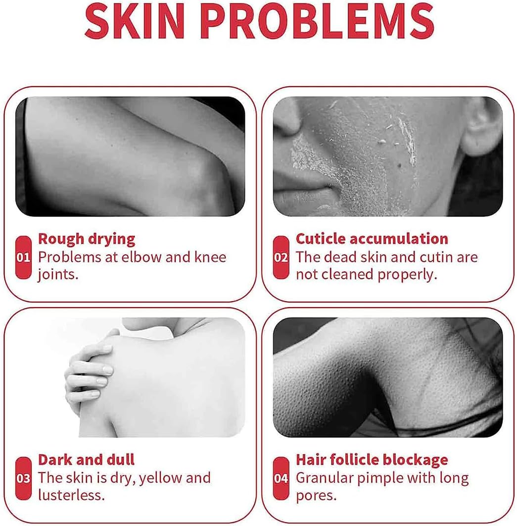 BIOAQUA Peach Extract Exfoliation, Peach Extract Fruit Acid Exfoliating Face Gel, Exfoliation Dead Skin Remover Brightening Peeling Scrub for Smooth Skin